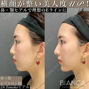BIANCA表参道 松田 朋子医師の症例