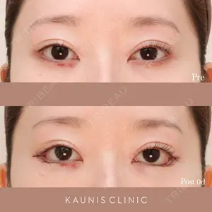 KAUNIS CLINIC（カウニスクリニック） 高野 敏郎医師の症例