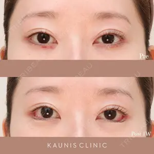 KAUNIS CLINIC（カウニスクリニック） 高野 敏郎医師の症例