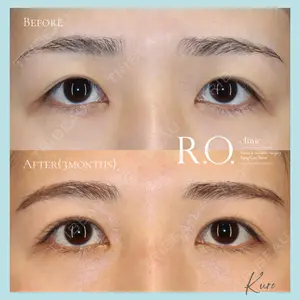 R.O.clinicの症例