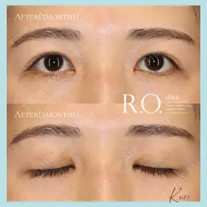 R.O.clinicの症例