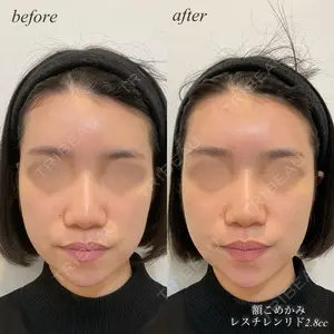 DMTC美容皮膚科 日本橋院 松井泉医師の症例
