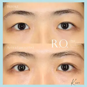 R.O.clinicの症例