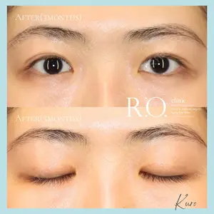 R.O.clinicの症例
