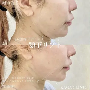 KAGA CLINIC 加賀 裕基医師の症例