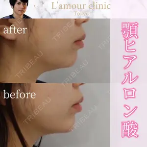 L‘amour clinic Tokyo【ラムールクリニック東京】の症例