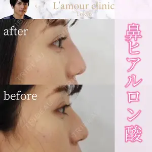 L‘amour clinic Tokyo【ラムールクリニック東京】の症例