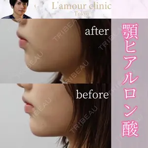 L‘amour clinic Tokyo【ラムールクリニック東京】の症例