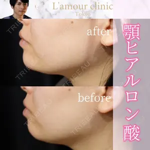 L‘amour clinic Tokyo【ラムールクリニック東京】の症例