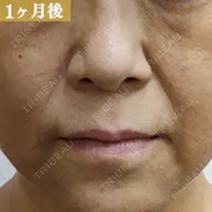 グランジョイクリニック 道上 育子医師の症例