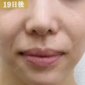 グランジョイクリニック 道上 育子医師の症例