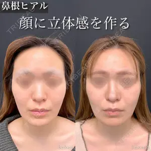 東京シンデレラ美容外科 池袋院 山本 紘子医師の症例