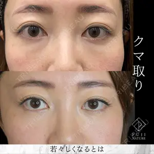 藤・ナチュレ美容クリニック 銀座院 小川 杏平医師の症例