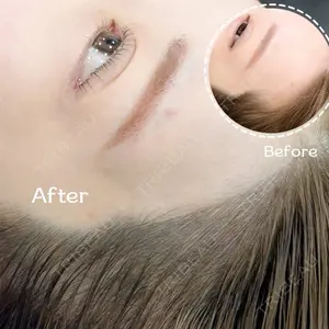 セカジソウォン医院-明洞店の症例