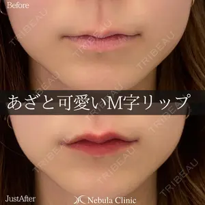 ネビュラクリニック 広島院の症例