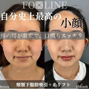 X CLINIC 銀座院 程 璐医師の症例