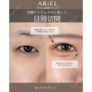 アリエル美容クリニック 大宮院 阪野 一世医師の症例