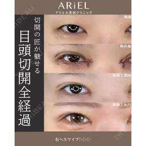 アリエル美容クリニック 大宮院 阪野 一世医師の症例