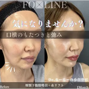 X CLINIC 銀座院 程 璐医師の症例