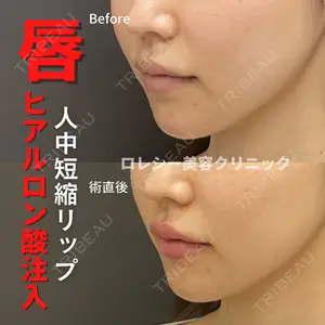 ロレシー美容クリニック 心斎橋駅前院 福留院長医師の症例