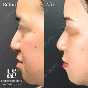 Leap beauty clinic 土門 駿也医師の症例