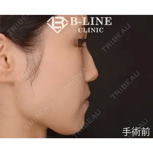 B-LINE CLINIC 池袋院 小池 康弘医師の症例