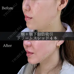 HAAB BEAUTY CLINIC 南青山本院（新院） 金子 雄医師の症例