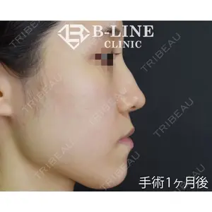 B-LINE CLINIC 池袋院 小池 康弘医師の症例