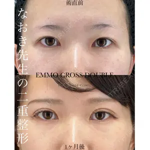 EMMO FACE CLINIC 大宮院 廣松 直樹医師の症例