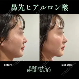 EMMO FACE CLINIC 大阪梅田院 山﨑 冴羅医師の症例