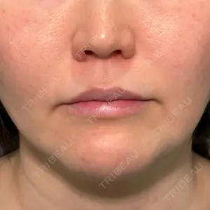 PRISM Beauty Clinic 新宿院 畑山 知輝医師の症例