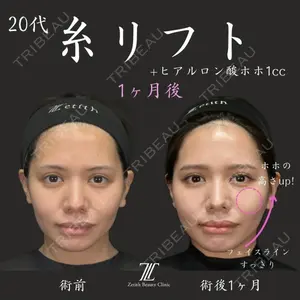 Zetith Beauty Clinic 福岡院 荻野 活医師の症例