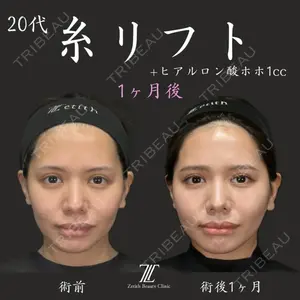 Zetith Beauty Clinic 福岡院 荻野 活医師の症例