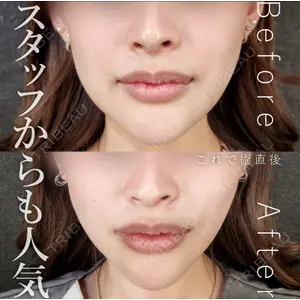 Tokyo Tensei Clinic 新宿院の症例