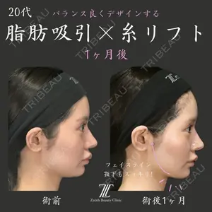 Zetith Beauty Clinic 福岡院 荻野 活医師の症例