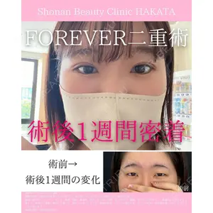 湘南美容クリニック 福岡院の症例