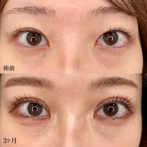 東京シンデレラ美容外科 大宮院の症例