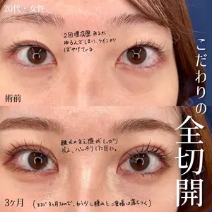 東京シンデレラ美容外科 大宮院の症例