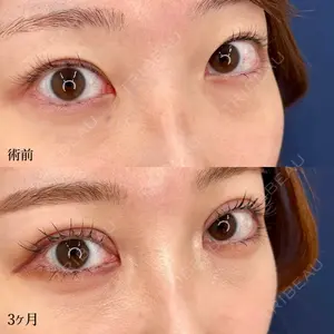 東京シンデレラ美容外科 大宮院の症例