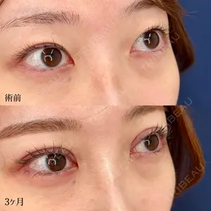 東京シンデレラ美容外科 大宮院の症例