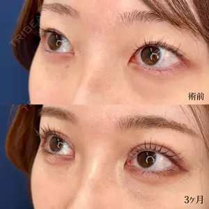 東京シンデレラ美容外科 大宮院の症例