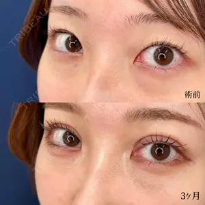 東京シンデレラ美容外科 大宮院の症例