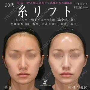 Zetith Beauty Clinic 福岡院 荻野 活医師の症例