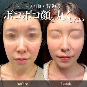 東京シンデレラ美容外科 池袋院の症例