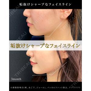 東京シンデレラ美容外科 池袋院の症例