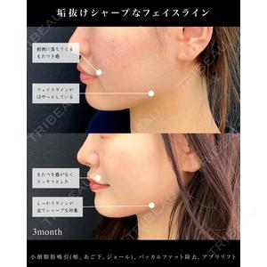 東京シンデレラ美容外科 池袋院の症例