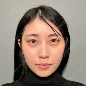 PRISM Beauty Clinic 町田院の症例