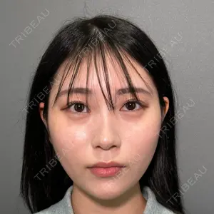 PRISM Beauty Clinic 町田院の症例