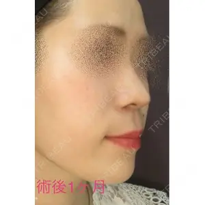 銀座TAクリニック 山田 真里江医師の症例