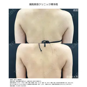 湘南美容クリニック 福岡院の症例